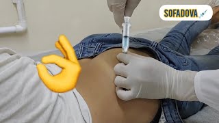 intramuscular IM shot an injection into the gluteal muscle [upl. by Oeniri178]