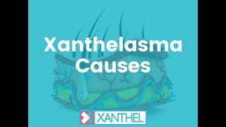 XANTHELASMA CAUSES What are the cause of Xanthelasma and Xanthomas  Brought To You By XANTHEL ® [upl. by Nbi]