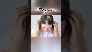 I Tried The One Solution For All Hair Problemsshortytshortshortvideo [upl. by Caraviello]