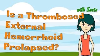 Is a Thrombosed External Hemorrhoid Prolapsed [upl. by Yelekalb556]