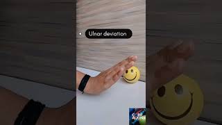 Exercise for carpal Tunnel syndrome physio anatomy relief viral effective mobilization fit [upl. by Hiroshi832]