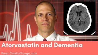 Atorvastatin and Dementia Do atorvastatin and other statins cause dementia and memory loss [upl. by Donaghue]