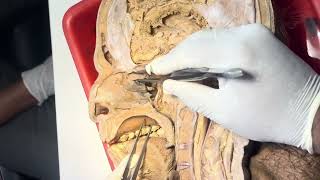 Lateral wall of nose dissection and sagittal section of head and neck [upl. by Erdnoed]