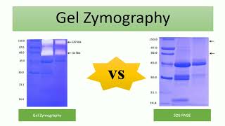 Gel zymography  protein gel electrophoresis 5 [upl. by Cirilla348]