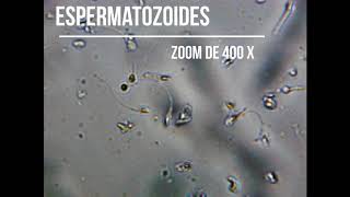 Espermatozoide 400X [upl. by Ellata]