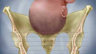 Fetal Descent Birth Station Progress Dilation Effacement Labor Contractions [upl. by Foley]