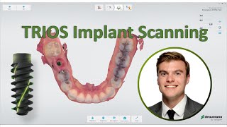 3shape TRIOS  Straumann Implant Scanning Workflow [upl. by Fesuoy337]