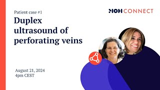 MOH Connect  Duplex ultrasound of perforating veins  Patient case 1 [upl. by Goldstein271]