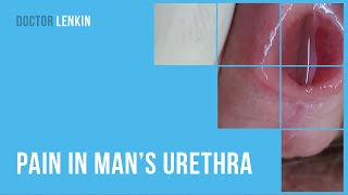 😕 Pain in man’s urethra [upl. by Enerol]