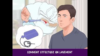 Comment effectuer un lavement [upl. by Andri514]