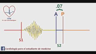 Soplo de la comunicación interauricular [upl. by Audun]