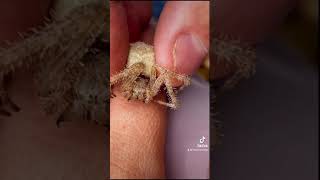 La morsure d’Araneus cavaticus une araignée sans danger pour l’humain spider wildlife [upl. by Bartie733]