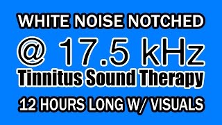 White Noise  Notch Filtered at 175 kHz for Tinnitus Therapy w Visuals [upl. by Ynagoham]