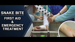 First Aid and Emergency Treatment  Snake Bite  HINDI [upl. by Etteiram594]