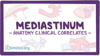 Anatomy clinical correlates Mediastinum [upl. by Nealey]