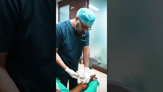 Lipoma Removal from patients body shorts [upl. by Anrym]