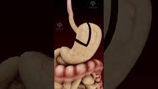 Gastric Bypass Laparoscopic Treatment shorts  creativelearning3d [upl. by Boswell377]