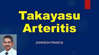 Takayasu Arteritis  Some Important Aspects [upl. by Ansev950]