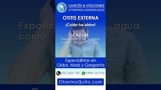 Otitis Externa [upl. by Servetnick881]