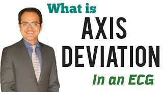 Axis Deviation in ECG Made Easy Causes How to determine Axis in ECG Explained ECG Lecture USMLE [upl. by Terrye487]