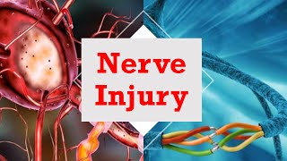 Nerve Injury [upl. by Halil434]