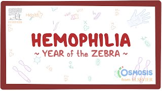 Hemophilia Year of the Zebra [upl. by Noraha254]