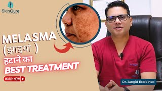 Best Treatment for Melasma  Laser Treatment for Melasma in Delhi  SkinQure  Dr Jangid [upl. by Rafi]