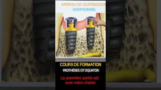 cours de formation dentaire quotOT Equatorquot laboratory dentist dental dentistry artandsciencelab [upl. by Shererd]