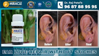 Ear Lobe Repair  Ear Holl Repair  Torn Ear Repair  Ear Pasting Lotion Available Call  9687889595 [upl. by Grearson]