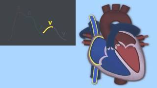 Interpreting Central Venous Pressure Waveforms by J DiNardo  OPENPediatrics [upl. by Eerised]