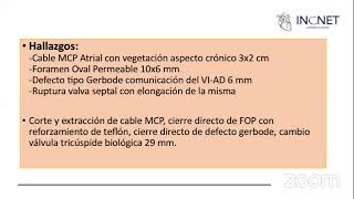 Defectos Tipo Gerbode [upl. by Magnum]