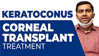 Treatment of Acute Corneal Hydrops in Keratoconus by FullThickness Corneal Transplant PK [upl. by Oniuqa]