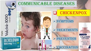 MEDICINAL TREATMENTS OF CHICKENPOX SYMPTOMS  PREVENTION AND VACCINATION [upl. by Grane121]