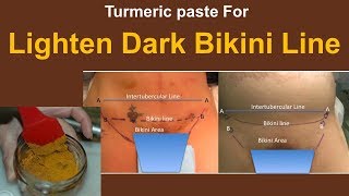 Lighten dark bikini line with Turmeric paste [upl. by Yatnwahs]