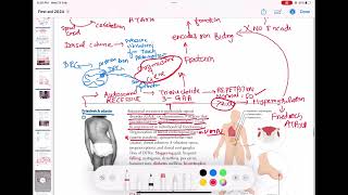 Friedreichs Ataxia symptoms amp Treatments neurology 140  First Aid USMLE Step 1 in UrduHindi [upl. by Andrien]