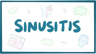 Sinusitis  causes symptoms diagnosis treatment pathology [upl. by Norvol990]