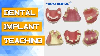 Dental Implant Teaching Model Maxillary Sinus Practice Model With Missing Tooth Dentist Student Stud [upl. by Grearson752]