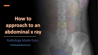 Abdominal Xray  Introduction and Step by step Approach in 10 minutes  For Doctors [upl. by Berger]