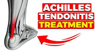 Tight Achilles Tendon Pain or Tendonitis Best Home Treatment [upl. by Wanids]