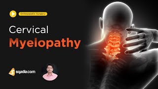 Cervical Myelopathy  Orthopaedic Surgery  Medical Student Lectures  VLearning [upl. by Clinton]