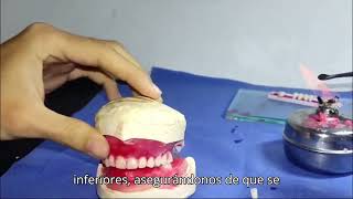 Enfilado dental  Carlos Escorcia  Jennifer Vega [upl. by Lednew]