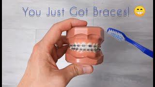 How to care for your new braces and your teeth [upl. by Rhodes]