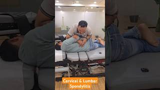 Cervical and Lumbar Spondylitis Treatment in India DrMushtaque 🇮🇳 chiropractor Migren sciatica [upl. by Granlund]