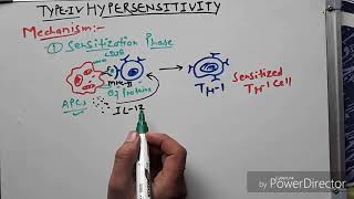 Hypersensitivity type 4 hindi [upl. by Eednar]