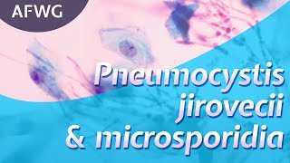 Latest on P jirovecii microsporidia – Prof D Marriott [upl. by Erdreid941]