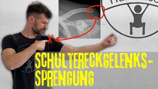 Schultereckgelenkssprengung  Mein Tossy 2  welche Therapiemöglichkeiten gibt es [upl. by Eniamahs]