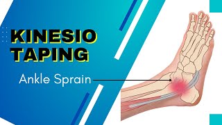 THE BEST and coolest Kinesiology Taping for an Ankle inversion sprain [upl. by Alleras]