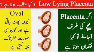 What is low lying placenta   Can Low Lying Placenta be dangerous to baby  Placenta previa [upl. by Sregor639]