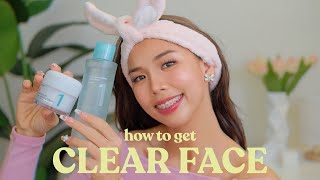 THE BEST SUMMER SKINCARE FOR OILY ACNEPRONE SKIN easy amp effective 💕😳 [upl. by Aicinad]