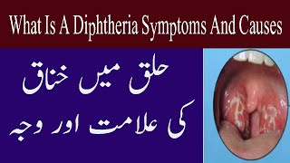 Diphtheria In Throat Cause And Symptoms In Urdu Halaq Ki Bimari Khanak Ki Alamat Aur Waja [upl. by Sorkin941]